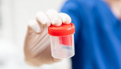 Detectan el primer caso en el mundo de una rara enfermedad transmitida por donación de esperma