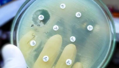 Brecha en la armadura bacteriana: El avance que permite a los antibióticos volver a ser letales
