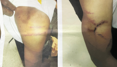 Denuncian golpiza a hombre con discapacidad detenido por supuesto robo en metalera de La Victoria