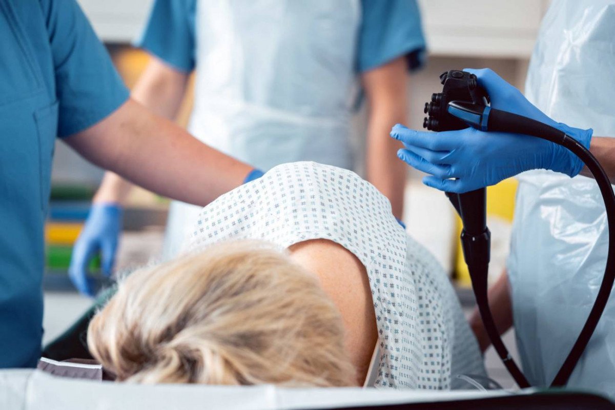 El diagnostico temprano es clave en cancer colorrectal la supervivencia puede alcanzar el 90
