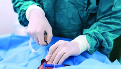 Piden apegarse a las guías médicas en implantación de stens coronarios
