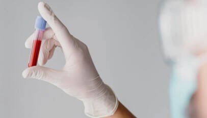 Una nueva prueba rastrea la vida útil de la sangre donada para su uso clínico