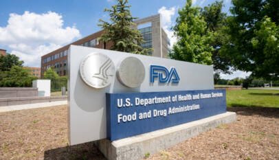AbbVie presenta solicitud ante la FDA sobre medicamento para adultos y adolescentes con alopecia areata severa AbbVie presenta solicitud ante la FDA sobre medicamento para adultos y adolescentes con alopecia areata severa