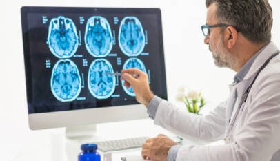 Identifican un factor que reduce el riesgo de demencia Identifican un factor que reduce el riesgo de demencia