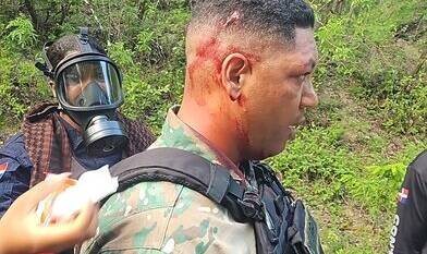 Tres policías y un capitán del Ejército resultan heridos durante tras agresión a pedradas en protesta en San Juan de la Maguana Tres policías y un capitán del Ejército resultan heridos durante tras agresión a pedradas en protesta en San Juan de la Maguana