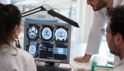 Una combinación de tratamientos mejora la recuperación tras un ictus grave