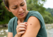 Por qué los mosquitos prefieren a ciertas personas y a otras no