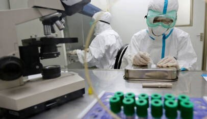 Rusia anuncia el registro este año de su primera vacuna contra el neumococo