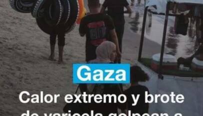 Gaza: calor extremo y un brote de varicela con más de 58.000 casos golpean a los desplazados